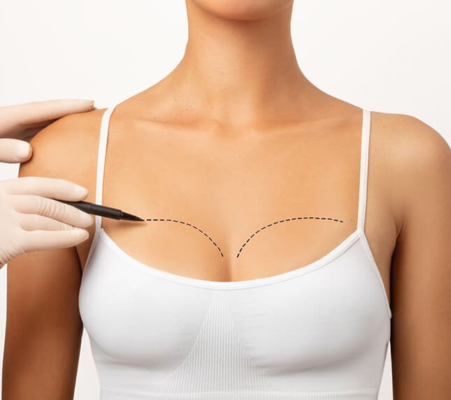 Breast Reconstruction Surgery - Dr Rajat Gupta - Plastic Surgeon in India - RG Aesthetics